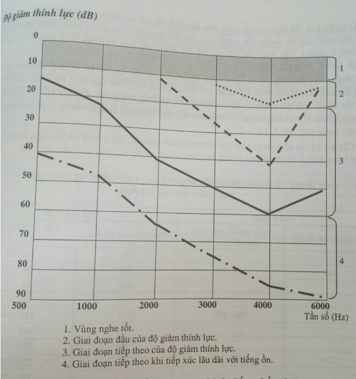 biểu đồ đo thính lực